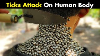 Ticks Bites On Human  Symptoms Causes And Treatment [upl. by Zel]