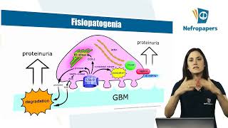 Aula Glomerulopatia Membranosa do Curso da Prova de Título Nefropapers Por Duda Vilanova [upl. by Anagnos]