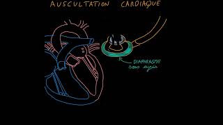 Auscultation cardiaque Souffles cardiaques bruits Partie 1 [upl. by Esilenna]