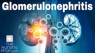 Renal Emergencies Glomerulonephritis [upl. by Archibald304]