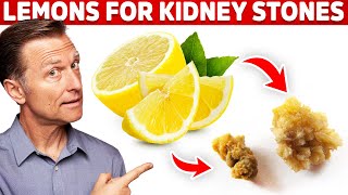 Eliminate Kidney Stones With Lemons – Kidney Stone Causes amp Lemon Benefits – DrBerg [upl. by Attehcram]