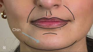 Facial Surface Anatomy Terminology [upl. by Tletski]