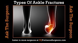 Types Of Ankle Fractures Seen By An Ankle Surgeon [upl. by Atterys]