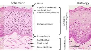 Premalignancies and Squamous Cell Carcinoma [upl. by Lemak]