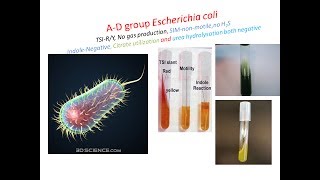 ADgroup E coli isolation [upl. by Brana]