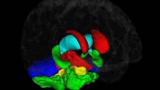 Brain Morphometry  Brain Image Analysis [upl. by Geneva717]