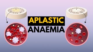 Aplastic Anaemia Causes Signs and Symptoms Diagnosis and Treatment [upl. by Ennaerb]