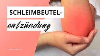 Schleimbeutelentzündung Bursitis an Knie Schulter amp Hüfte [upl. by Box546]