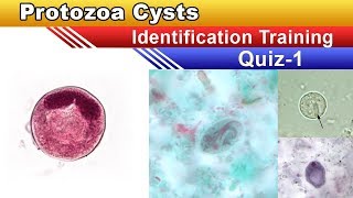 Protozoa Cysts Identification Training Quiz  Part 1 [upl. by Ynattir]