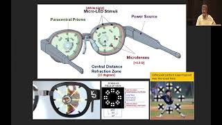 AIOC 2023 IC400 topic Dr DESAI SANJIV Myopic Defocus and the DIMS HALT amp Kubota glasses [upl. by Nysa]