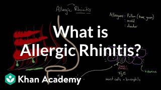 What is allergic rhinitis  Respiratory system diseases  NCLEXRN  Khan Academy [upl. by Zumwalt]