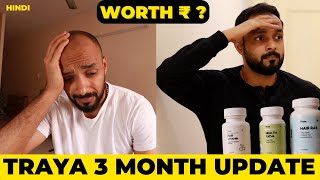 ✅ Traya Hair Regrowth👩‍🦲3 Month Progress Update 👉 My Honest Opinion 🟡 from hair loss to Thicker Hair [upl. by Murielle]