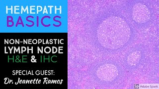 Hemepath Basics NonNeoplastic Lymph Node Histology amp Immunostains with Dr Jeanette Ramos [upl. by Castara]