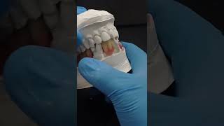 QUE CALIDAD dentalabchapala dentista dentales tipsdentales laboratoriodental [upl. by Lammaj]