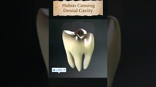 Tooth Trouble What are Cavities and How to Prevent Them 🦷दांतो की सड़न yt shorts ytshortsindia [upl. by Holmes639]