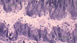 Cryptosporidium What You Should Know [upl. by Ayidah186]