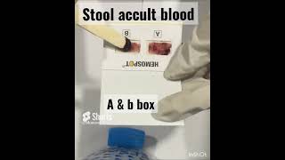 Stool occult blood test laboratory diagnosis foryou medical youtubeshorts viral trending [upl. by Hebert514]