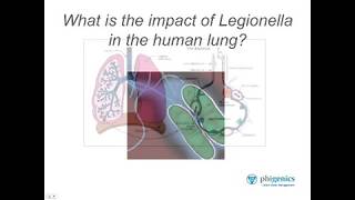 Ask the Expert  Part 5 What is Legionellas impact on health [upl. by Hana883]