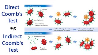 DCT amp ICT pathology pathologylab hematology hemepath immunology [upl. by Ecnahc]