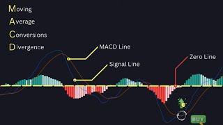 What is Macd Real Vide💯💯indicators In Live Market how to use macd indicator macd sikhe Hindi me [upl. by Wiggins]