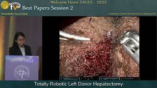 Totally Robotic Left Donor Hepatectomy [upl. by Adamo956]