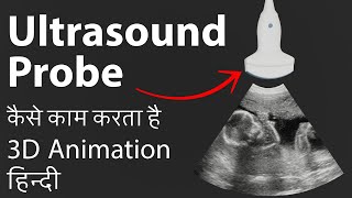 How ultrasound probe works  3D Animation Hindi  Ultrasound Probe कैसे काम करता है [upl. by Paxon]