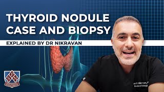 Thyroid Nodule case and biopsy explained by Dr Nikravan [upl. by Huxley]