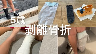 【5歳骨折しました。】ギブスセット購入／お風呂、幼稚園児はどうした？／靴は？ [upl. by Griseldis]