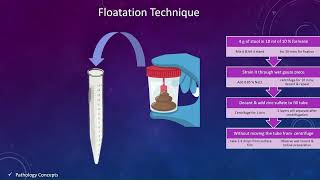 Concentration techniques in Stool  Floatation techniques  Sedimentation techniques  parasites [upl. by Sara-Ann]