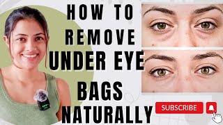 HOW TO REMOVE UNDER EYE BAGS NATURALLY  WHAT CAUSES UNDEREYE BAGS HOW TO GET RID OF UNDEREYE BAGS [upl. by Micheil]