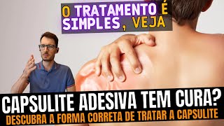 Capsulite adesiva O que causa e como tratar da forma correta Como recuperar o movimento do ombro [upl. by Anileva445]