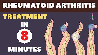 Rheumatoid Arthritis Treatment  New Medicines and Updates [upl. by Rockel]