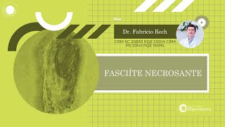 O que é Fasciíte Necrosante [upl. by Debi472]