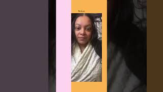 dp Hue Apple Cider Vinegar Hair Rinse  Aleah Alvarado [upl. by Urbas]