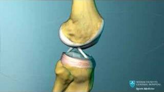 Knee Ligament Anatomy Animation [upl. by Fotzsyzrk]