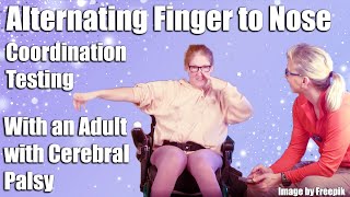 Alternating Finger to Nose Coordination Testing with an Adult with Athetoid Cerebral Palsy [upl. by Atikkin]