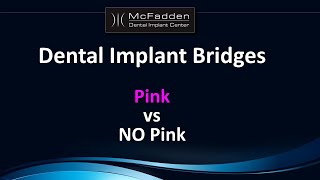 Dental Implant Bridges Pink or NO Pink [upl. by Ivens]