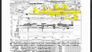 Understanding Clinical Waveforms recorded with the MB Jr  2 of 2avi [upl. by Vivi300]