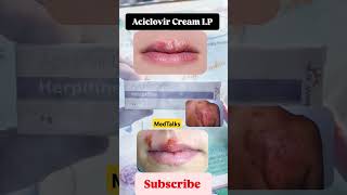 Aciclovir Cream IP for herpes zoster skin infection youtubeshorts MedTalks777 [upl. by Nivloc]