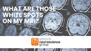 What are the white spots on my MRI [upl. by Howie]