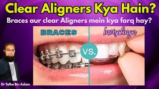 Clear Aligners Invisible Aligners procedure Braces vs clear aligners Invisalign [upl. by Dewar]