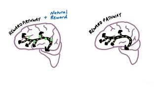 How an Addicted Brain Works [upl. by Nuarb]