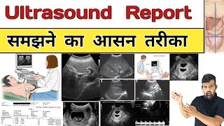 Ultrasound Report  Sonography  USG  Gynacology  Doctor  Nursing  Hospital  Treatment  Bhms [upl. by Dnomsad278]