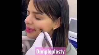 Dimpleplasty Creating a cheek dimple [upl. by Lampert]