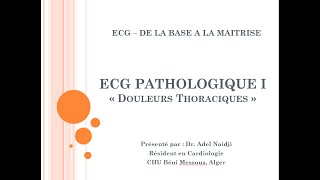 5  ECG Pathologique I  Douleurs Thoraciques Partie 02 [upl. by Ahkos]