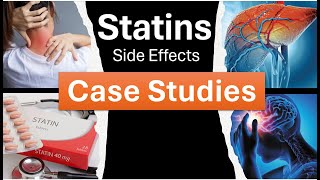 Statin Side Effects Case Studies [upl. by Lletnom]