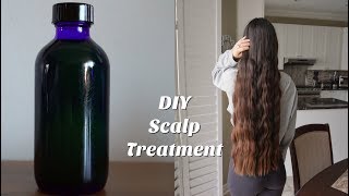 DIY Scalp Treatment for Hair Growth [upl. by Eniluqaj]