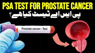 What To Do Next When Your PSA Levels Are High Prostate Specific Antigen Explained [upl. by Etac]