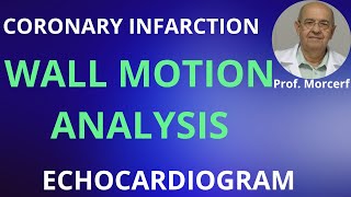 Three rules to analyze LV segmental contraction [upl. by Nahn]