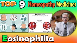 Eosinophilia Symptoms and homeopathy medicine  Dr P S Tiwari [upl. by Nira107]